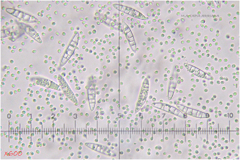 Ascocoryne cylichnium photo 2