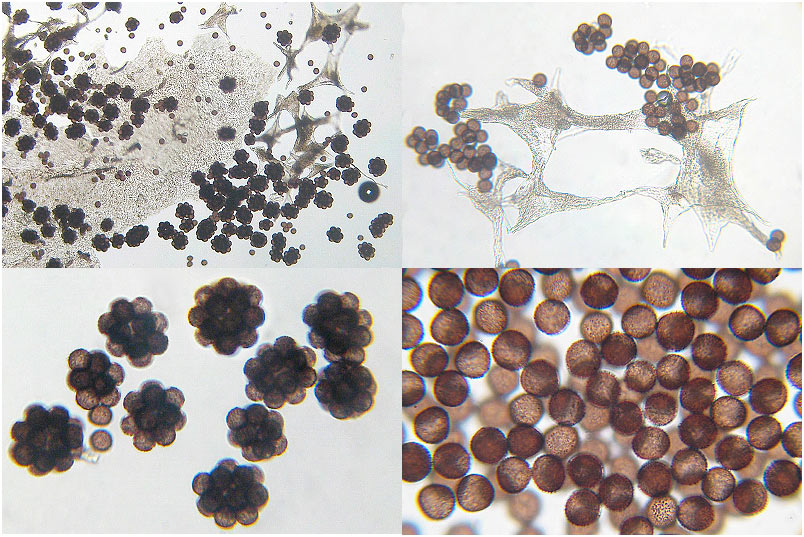 Badhamia utricularis photo 4